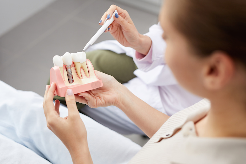 dental implant model held by woman at dental office