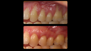 Before and after dental treatment