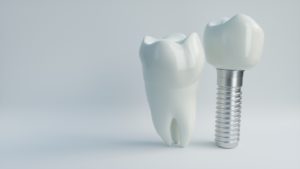 Model dental implant in Belmont next to model tooth