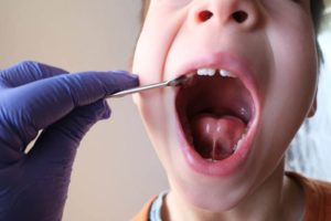 gloved hand checks child's teeth